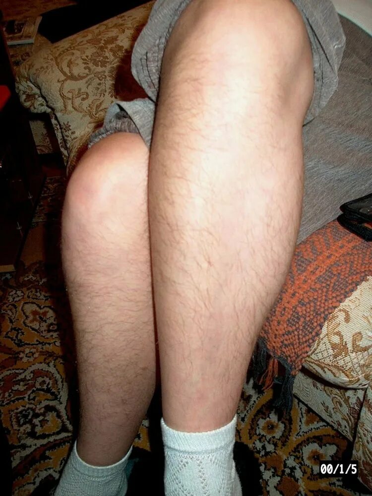 Рассказы про волосатые. Stocking hairy Legs up крупно очень. Slyvie hairy less. 80s hairy Legs. Hairy ass фото с мобильника.