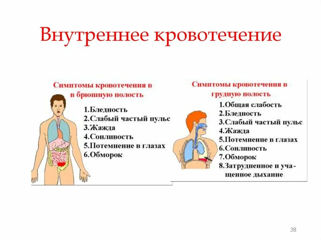 Внутреннее кровотечение у ребенка симптомы