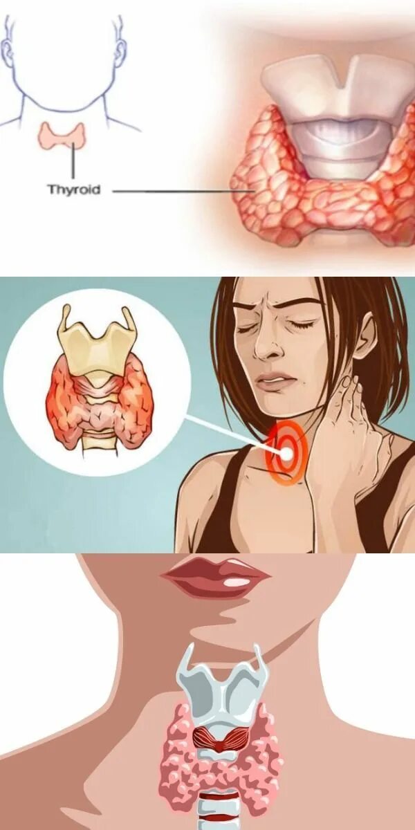 Что такое щитовидная железа. Щитовидная жележелеза. Щитовидная щитовидная железа. Щитовидная железа это орган.