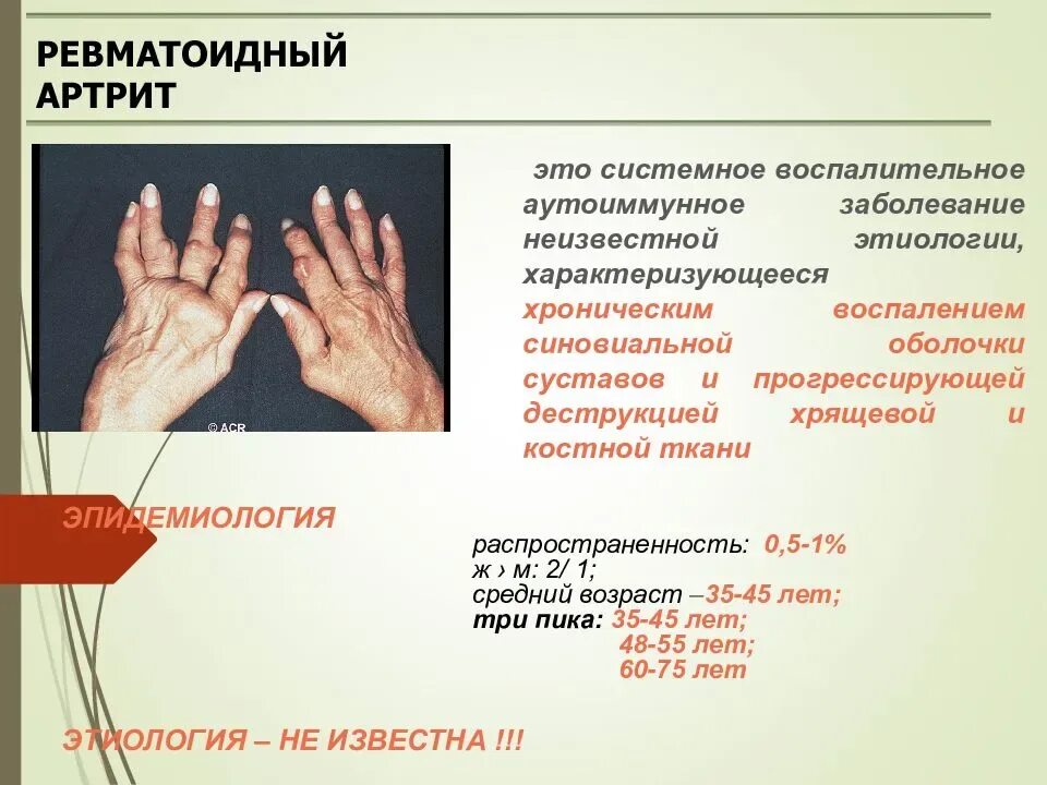 Ревматоидный артрит это. Ревматоидный артрит полиартрит клиника. Ревматоидный артрит субфебрилитет. Ревматический артрит и ревматоидный артрит. Этология ревматоидный артрит.