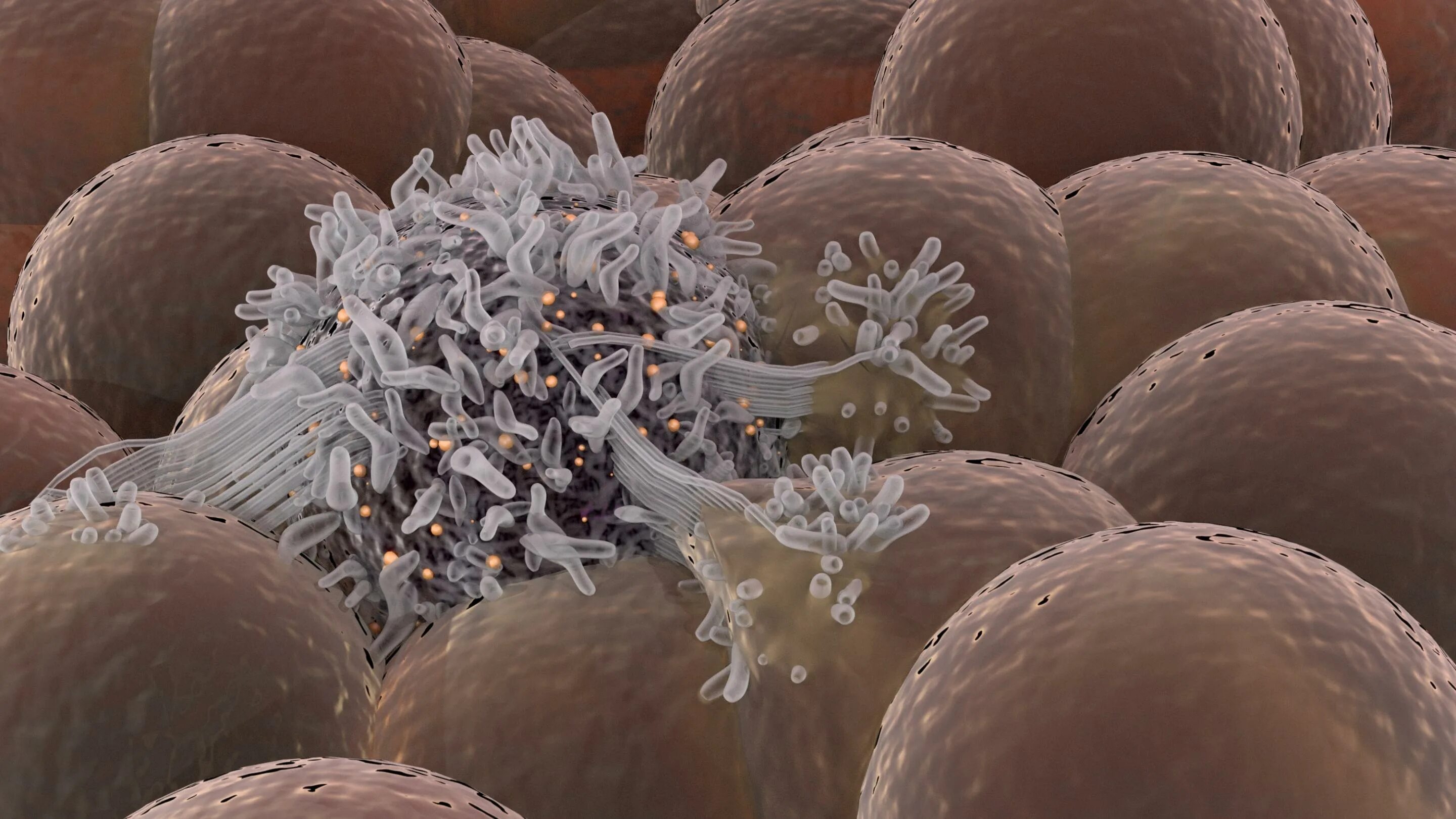 Злокачественная опухоль. Раковые стволовые клетки. Злокачественные клетки. Стволовая клетка и раковая клетка.