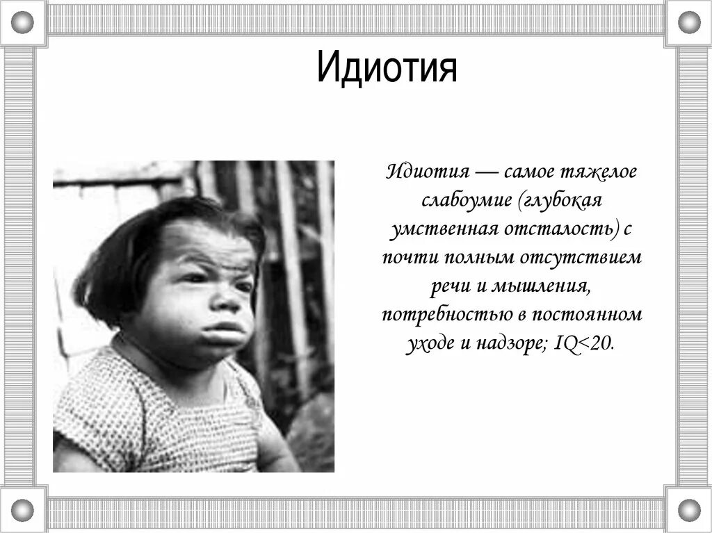 Легкое слабоумие. Умственная отсталость дебильность Имбецильность идиотия. Классификация умственной отсталости идиотия. Глубокая умственная отсталость (идиотия).. Степени умственной отсталости олигофрения.