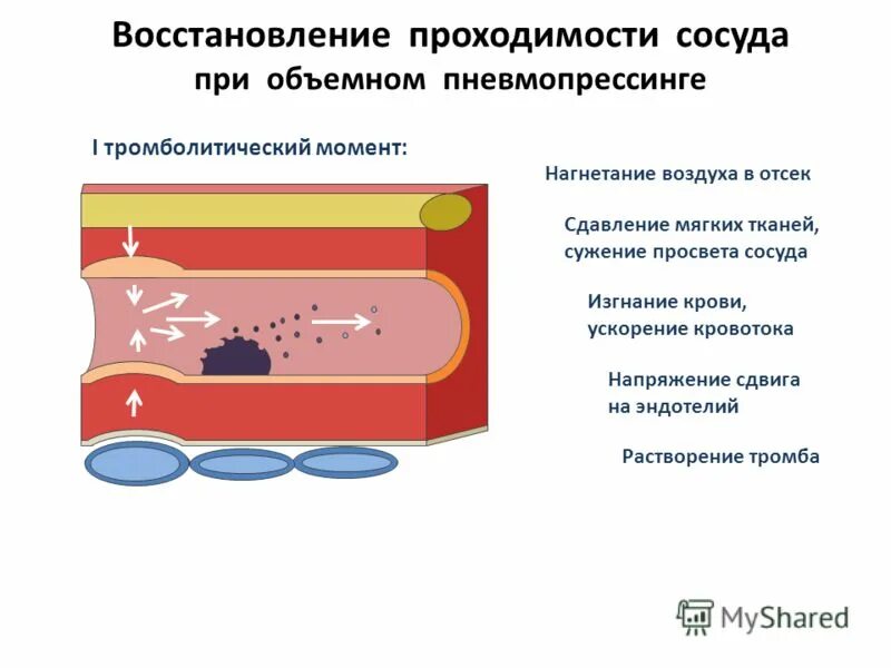 вещество суживающее просвет кровеносных сосудов. просвет кровеносных сосудов. сужение просвета сосудов. вещество суживающее просвет кровеносных сосудов. атеросклеротическое поражение сосудов.