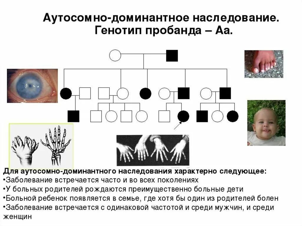 Аутосомно-доминирующий Тип наследования. Родословная с аутосомно-доминантным типом наследования. 1) Аутосомно-доминантный. Родословная аутосомно-доминантный Тип наследования генотипы. Аутосомное наследование пример