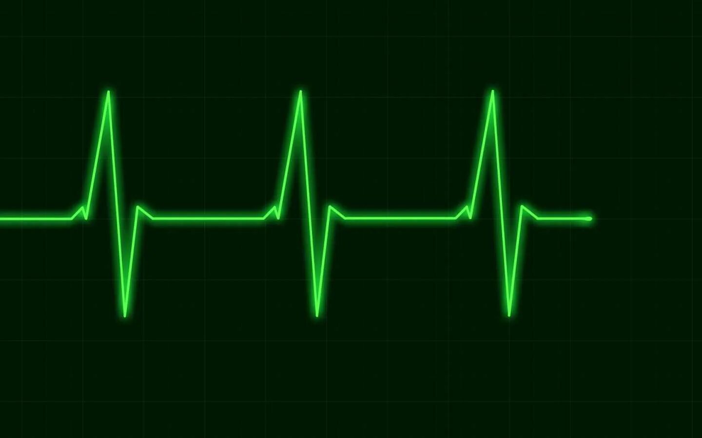 Эффект сердцебиения. Пульс. Пульс рисунок. Пульс сердца. Кардиограмма.