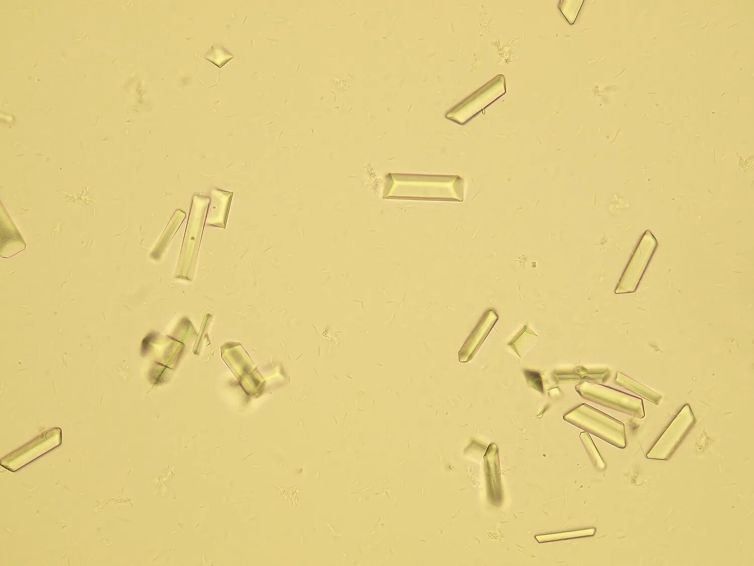 Фосфаты в какой моче. Струвиты оксалаты трипельфосфаты. Струвиты и оксалаты. Струвиты микроскопия. Кристаллы трипельфосфаты в моче.