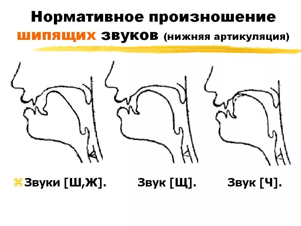 Артикуляция произношения звука и. Артикуляционный профиль шипящих звуков. Логопедические профили шипящих звуков. Постановка звука шипящих звуков. Правильная артикуляция шипящих звуков.