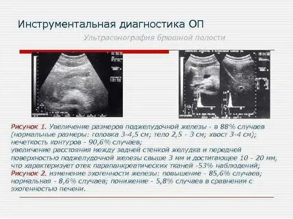 Структура поджелудочной диффузно неоднородная эхогенность повышена