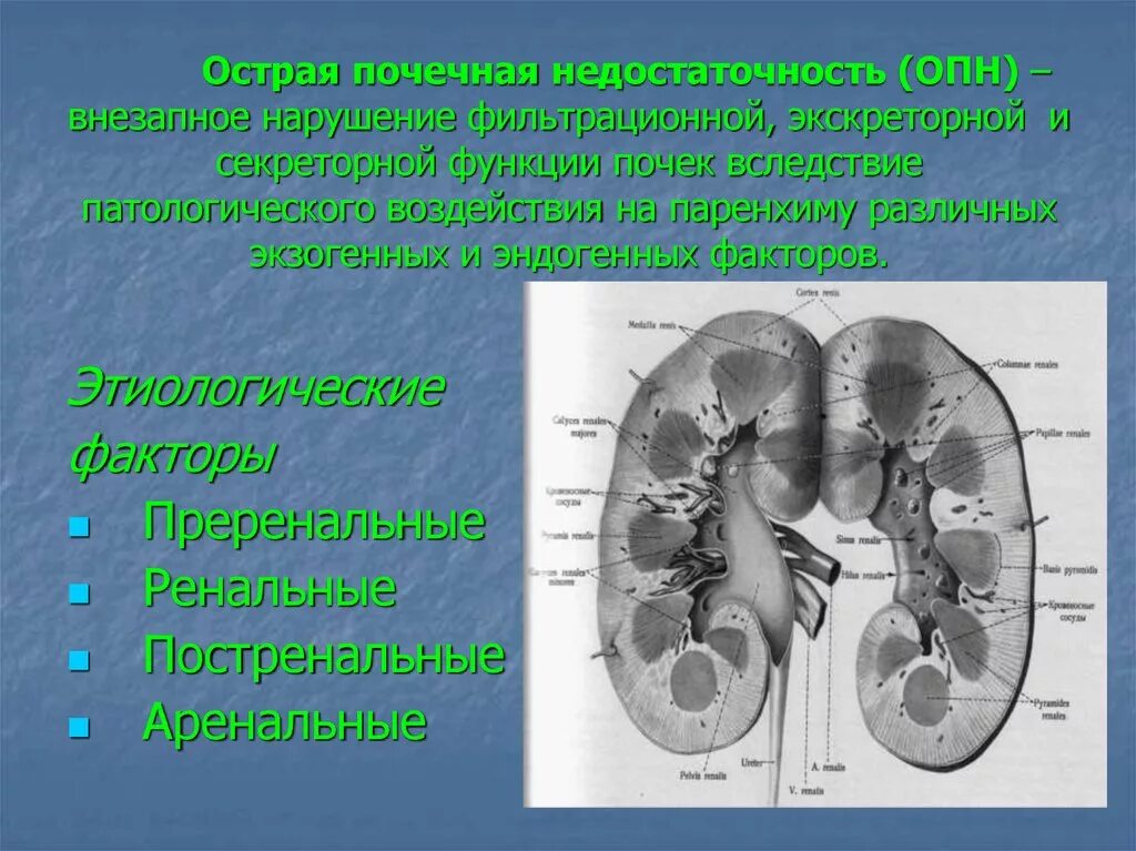 Преренальная острая почечная недостаточность клиника. Острая почечная недостаточность (ОПН). Название почки при острой почечной недостаточности. Остро печеная недостаточность. Одной из причин почечной недостаточности является