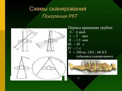 Лучевая разметка