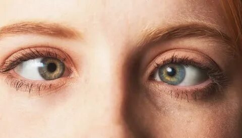 Cross eyed