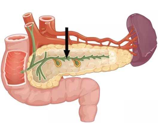 Вирсунгов проток это. Вирсунгов проток поджелудочной. Вирсунгова протока поджелудочной железы. Вирсунгов проток анатомия.