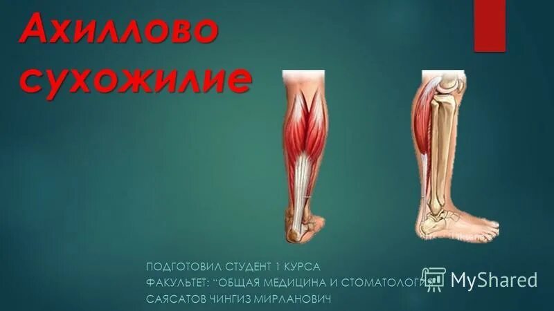 Ахиллесова пята анатомия. Где находится ахиллесова пята. Ахиллесова пята анатомия. Ахиллесова пята анатомия. Пяточное ахиллово сухожилие функции.