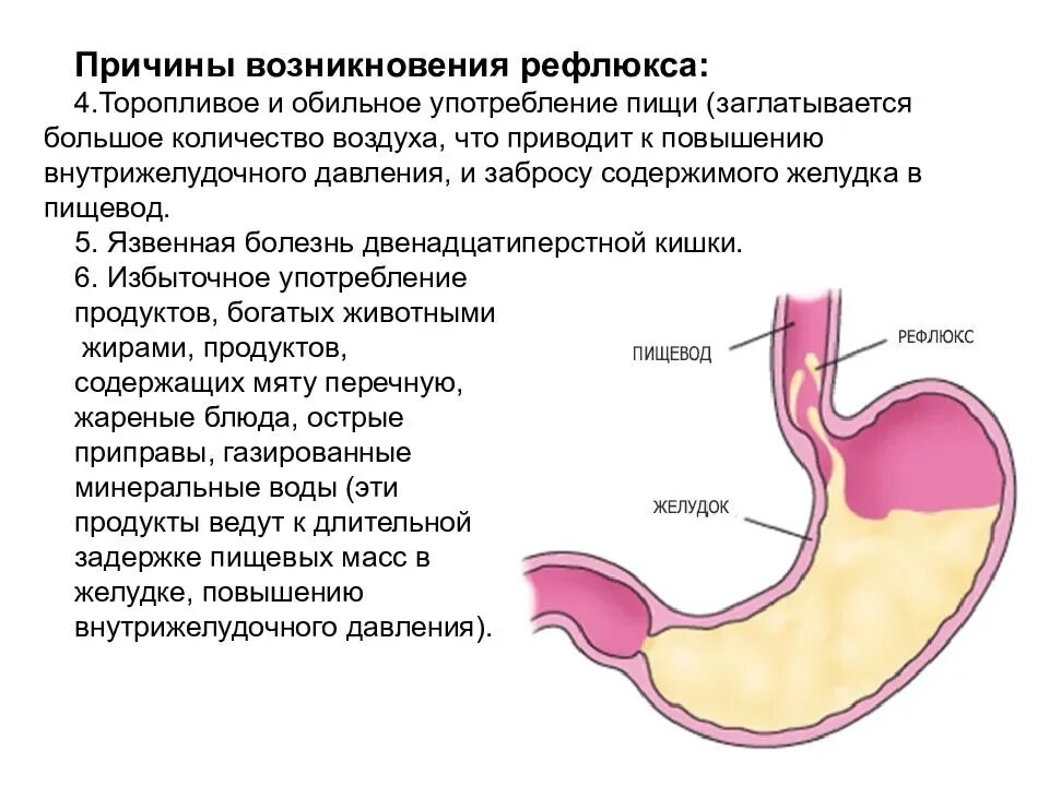 Как лечить пищевод желудка