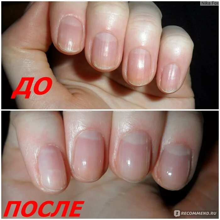 Маникюр через неделю. Ногти до и после отрастания. Ногти до и после отращивания. Наращивание ногтей до и после.