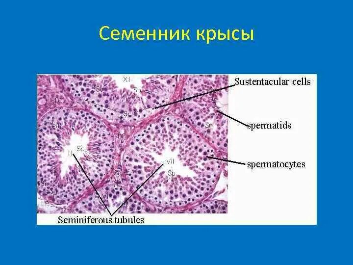 Семенник гистология препарат. Семенник гистология препарат