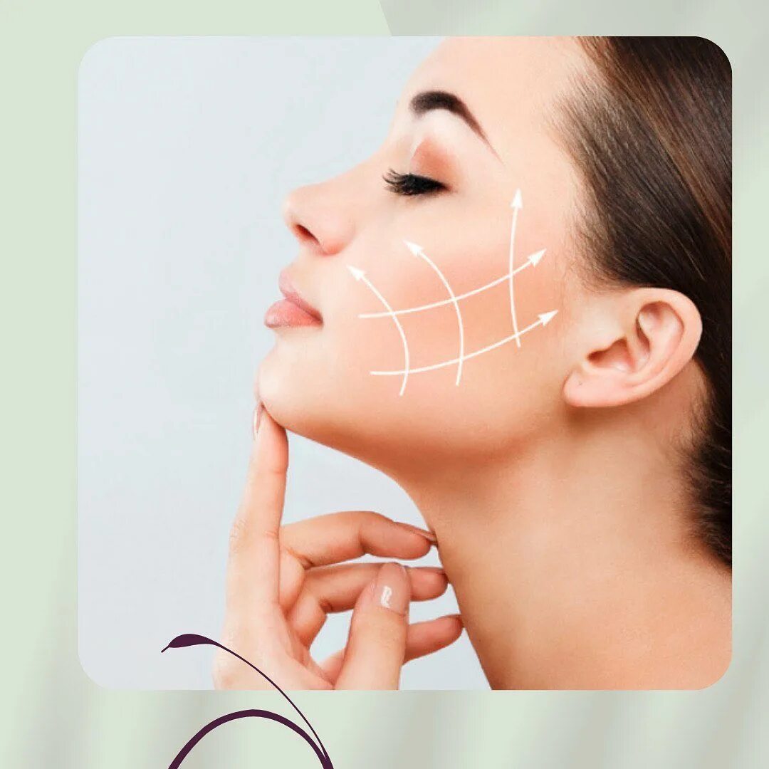тредлифтинг нефертити. схемы постановки мезонитей на лицо. сколько нитей нужно для подтяжки лица. схемы введения мезонитей. мезонити реклама.