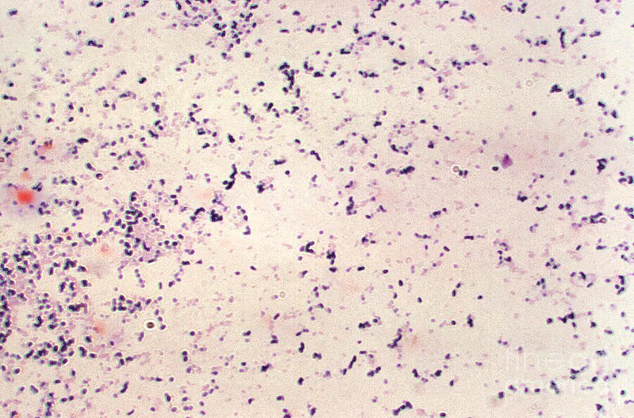 Peptostreptococcus spp. Пептококки и пептострептококки. пептострептококки микроскопия. грамположительные кокки: peptococcus, peptostreptococcus.. пептострептококки микробиология.