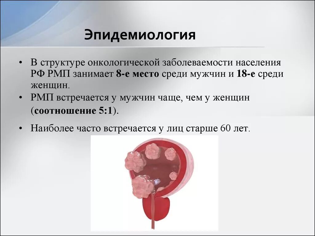 Опухоли мочевого пузыря классификация. Факторы риска опухоли мочевого пузыря. Эпидемиология опухолей мочевого пузыря. Факторы риска ракмояевого пузыря.