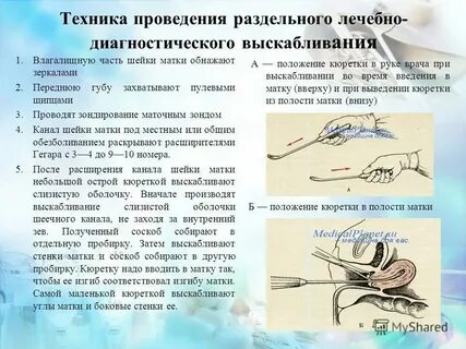 Выделения после чистки матки