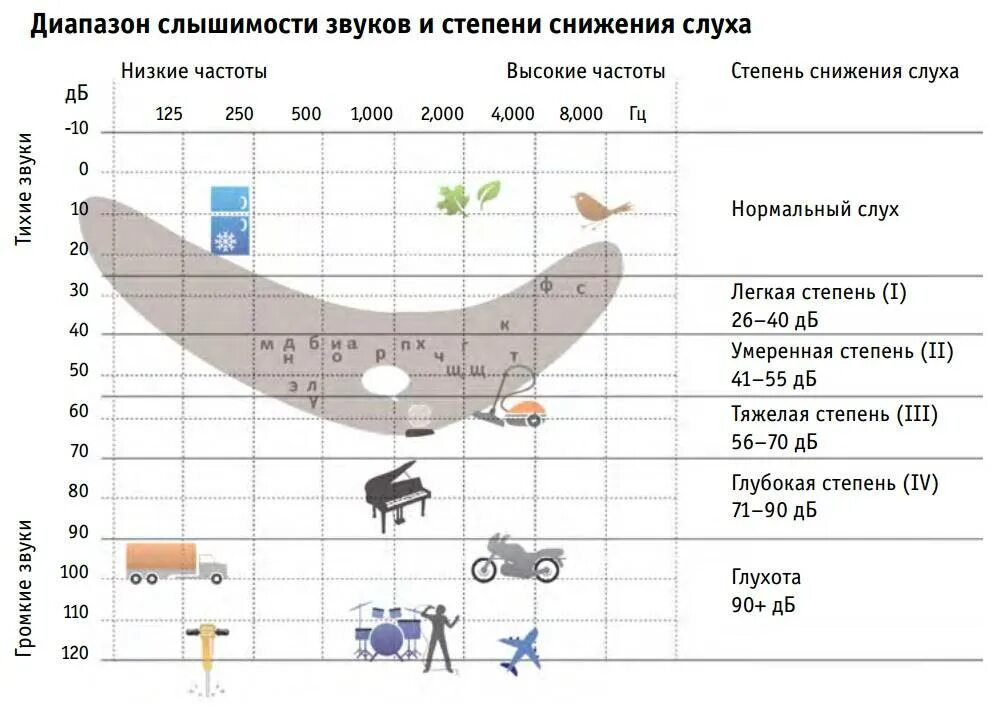 Ухо децибел. Диапазон слышимости звуков и степени снижения слуха. Диапазон слуха человека в Гц. Диапазон слышимости частоты человека. Уровни потери слуха.