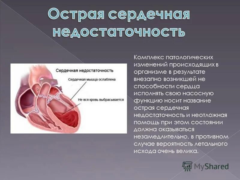 Признаки сердечной деятельности. Острая и хроническая сердечная недостаточность понятие. Острой сердечной недостаточности. Сердечно-сосудистая недостаточность. Сердечный недостаточность.