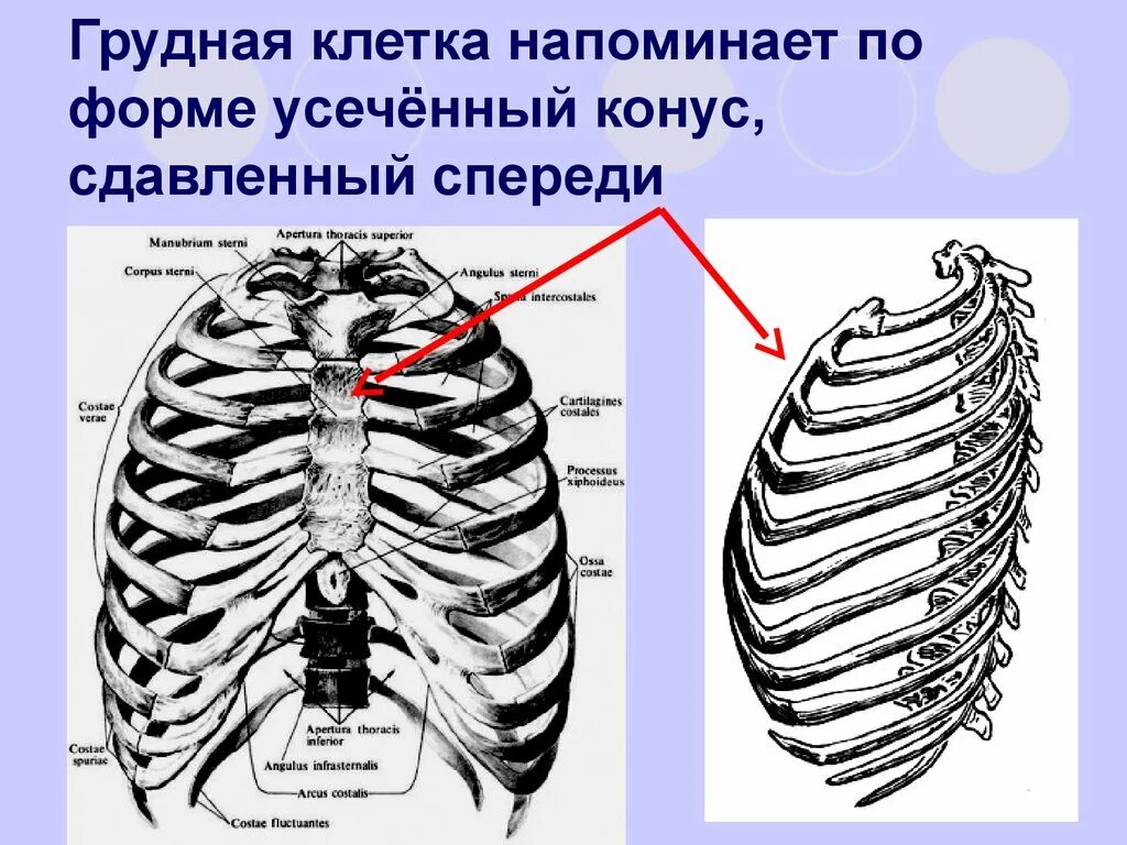 Сдавленная грудная клетка. Конусная грудная клетка. Сжатие груди