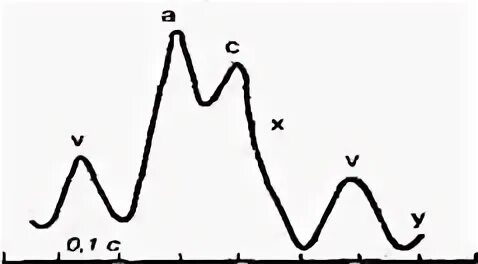 Венозный пульс, флебография. Артериальный и венный пульс физиология. Флебограмма венозного пульса. Флебограмм. Флебограмма физиология схема.