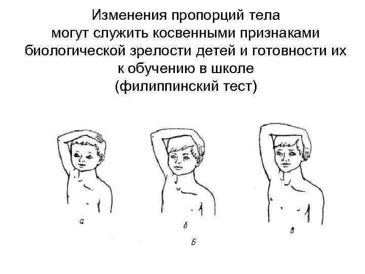 О чем может сообщить филиппинский тест. Филиппинский тест. проведение и оценка филиппинского теста у детей. филиппинский тест готовности ребенка к школе. физиологическая готовность к школе тест.