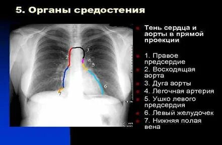 Что значит средостение значимо расширено