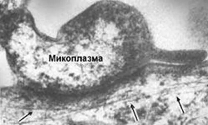 Урогенитальный микоплазмоз. Заболевания микоплазм. Микоплазмоз у мужчин симптомы