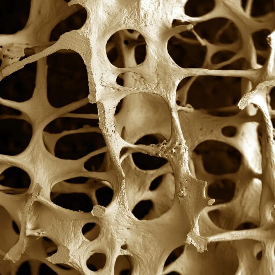 Костная ткань остеопороз. Губчатая костная ткань под микроскопом. Кость под микроскопом. Пористые кости.