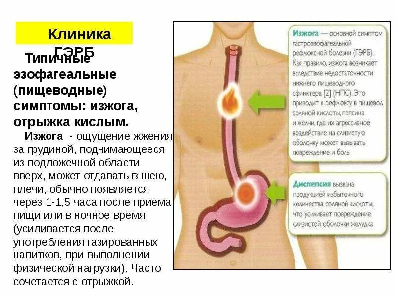 Почему идет постоянная отрыжка из желудка