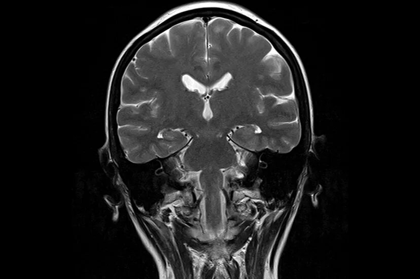 Мрт головного мозга санкт петербург. Мрт снимок. Снимок головного мозга. Томография мозга. Мрт головы.