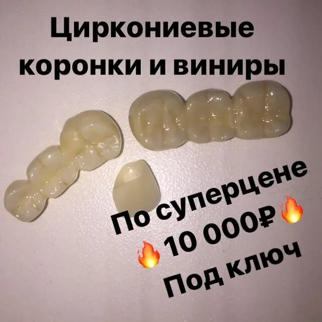 циркониевые коронки недостатки отзывы. цирконий коронки до и после. цирконовые коронки до и после. циркониевые коронки недостатки отзывы. циркониевые коронки b2 b3.