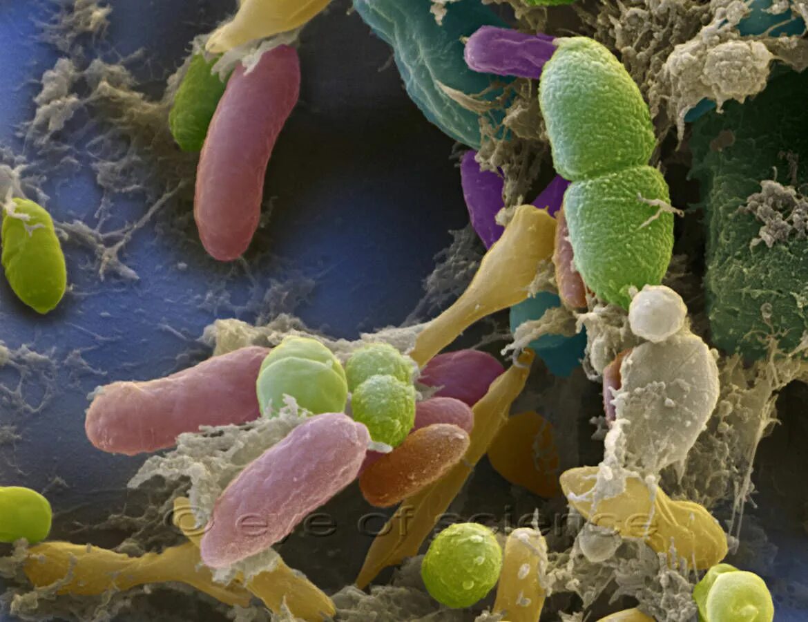 Вредоносные организмы. Патоген бактерия. Гарднерелла биопленки. Болезнетворные микроорганизмы. Патогенные микробы.