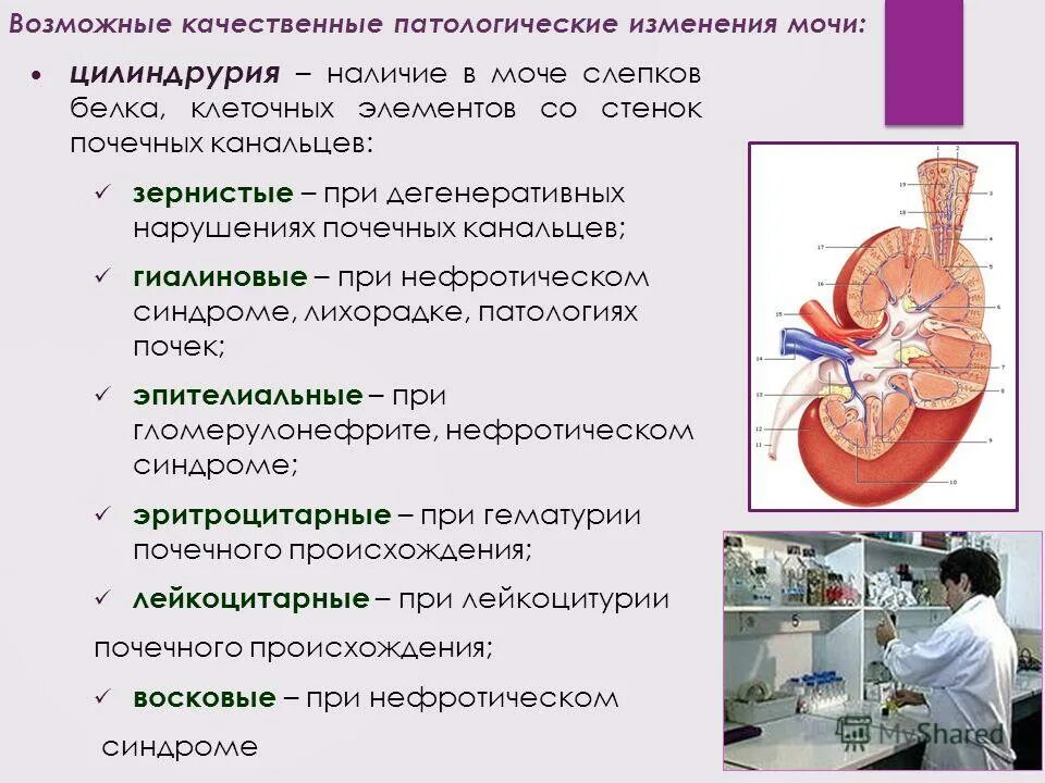 Каковы последствия нарушения работы органов мочевыделения. Строение почек и мочевыводящих путей. Морфофункциональные особенности почек. Заболевание мочевой системы 8 класс. Основные симптомы при патологии мочевыделительной системы.