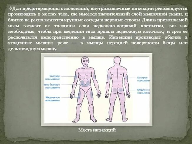 Инъекция в 6. Основные места для внутримышечного введения. Места для внутримышечных инъекций. Внутримышечные инъекции места введения. Места на теле для внутримышечных инъекций.