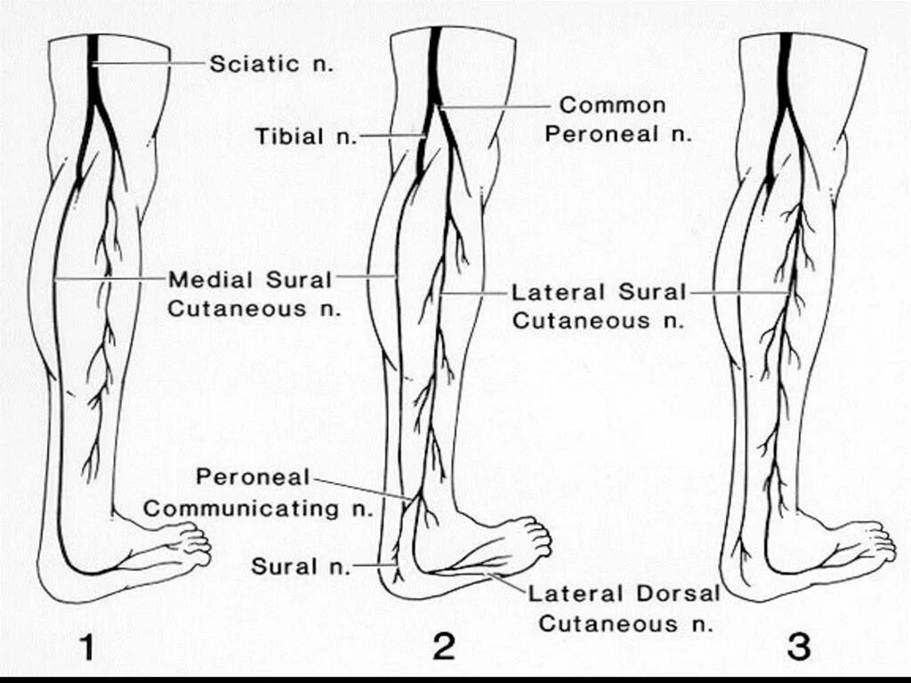 N suralis. Икроножный нерв анатомия. Sural nerve икроножный нерв. N suralis анатомия. Suralis нерв gastrocnemius.