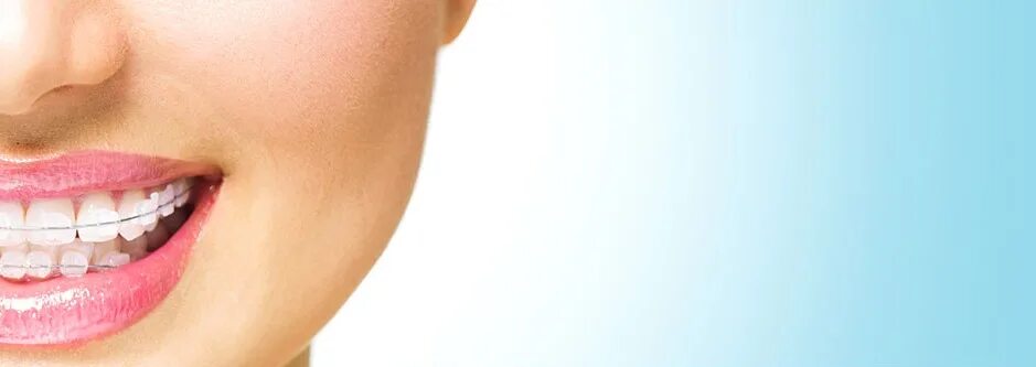 сизикова юлия вячеславовна стоматолог, стоматолог-ортодонт. сапфировые брекеты безлигатурные. подросток у стоматолога. сапфировые брекеты лигатурные. ортодонт бобруйск.