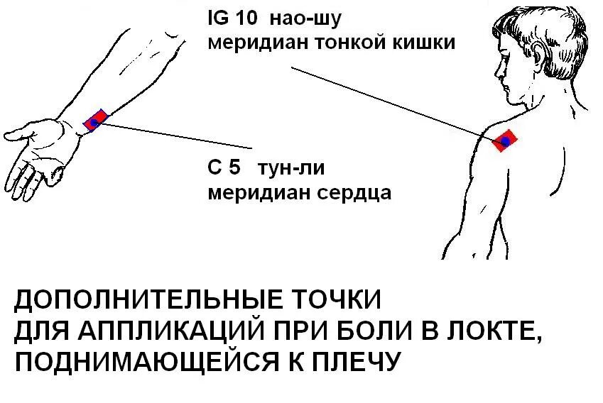 Болит локоть отдает в руку. Болевые точки при болях в локтевом суставе. Болевая точка на локте. Болит точка в локтевом суставе.