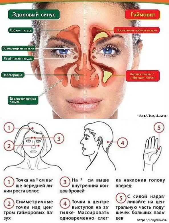 психосоматика таблица заболеваний тонзиллит. заложенность носа психосоматика. гайморовы пазухи психосоматика. синусит и гайморит психосоматика. гайморит психосоматика.