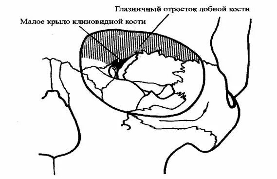 Глазничный отросток небной кости. Малое крыло клиновидной кости в глазнице. Стенки глазницы анатомия. Глазная впадина 6 букв