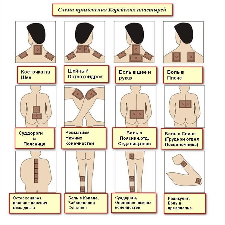 Пластыри корейские Gold Insam пластырь Корея. Перцовый пластырь шейный остеохондроз. Куда правильно наклеивать перцовый пластырь. Перцовый пластырь при хондрозе.