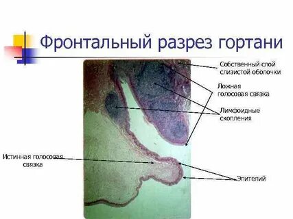 Собственный слой слизистой оболочки