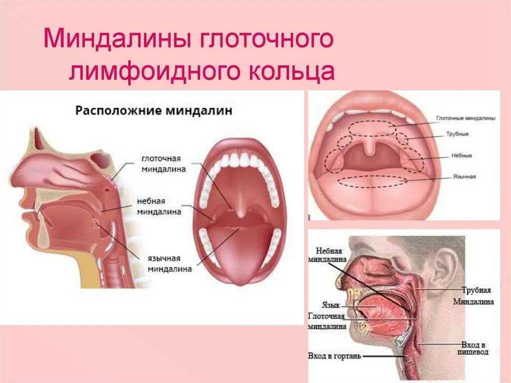 Горловая р у ребенка. Миндалины лимфоэпителиального глоточного. Лимфоидная ткань глоточного кольца. Анатомия миндалины глоточного кольца. Гланды глоточные миндалины.