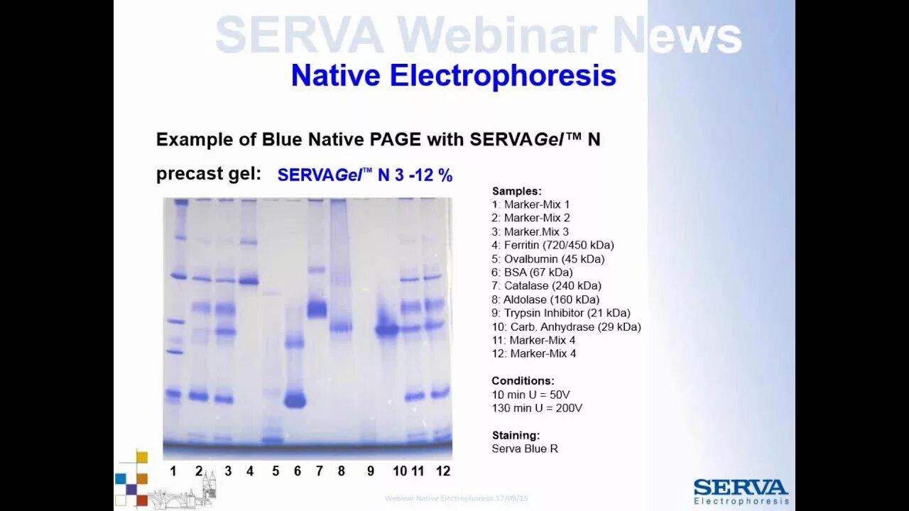 Native Gel Electrophoresis. Native Electrophoresis. Gel Electrophoresis Results photo. Native Blue.