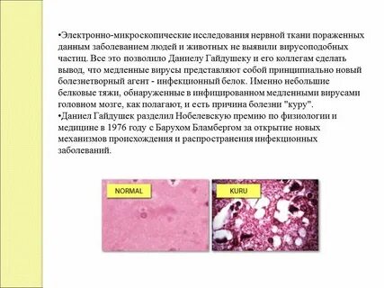 Пораженная ткань