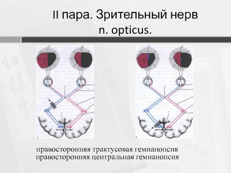 Зрительный нерв в головной мозг. Зрительный анализатор 2 пара. 2 Пара зрительный нерв. Зрительный нерв 2 пара анатомия. Зрительный нерв ЧМН.