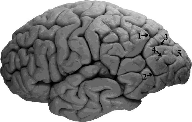 Извилины мозга центры. Извилины коры больших полушарий. Sulcus intraparietalis.